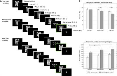 Face Processing in Developmental Prosopagnosia: Altered Neural Representations in the Fusiform Face Area